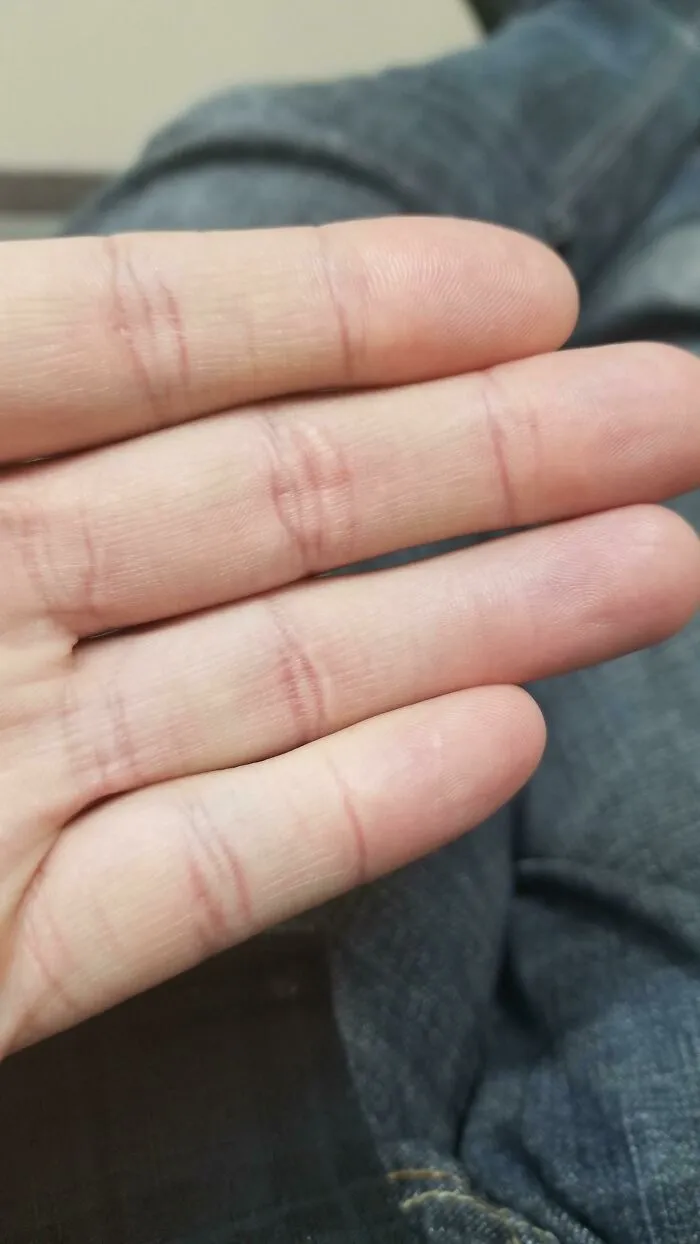 Close-up of fingers with unusual crease glitches