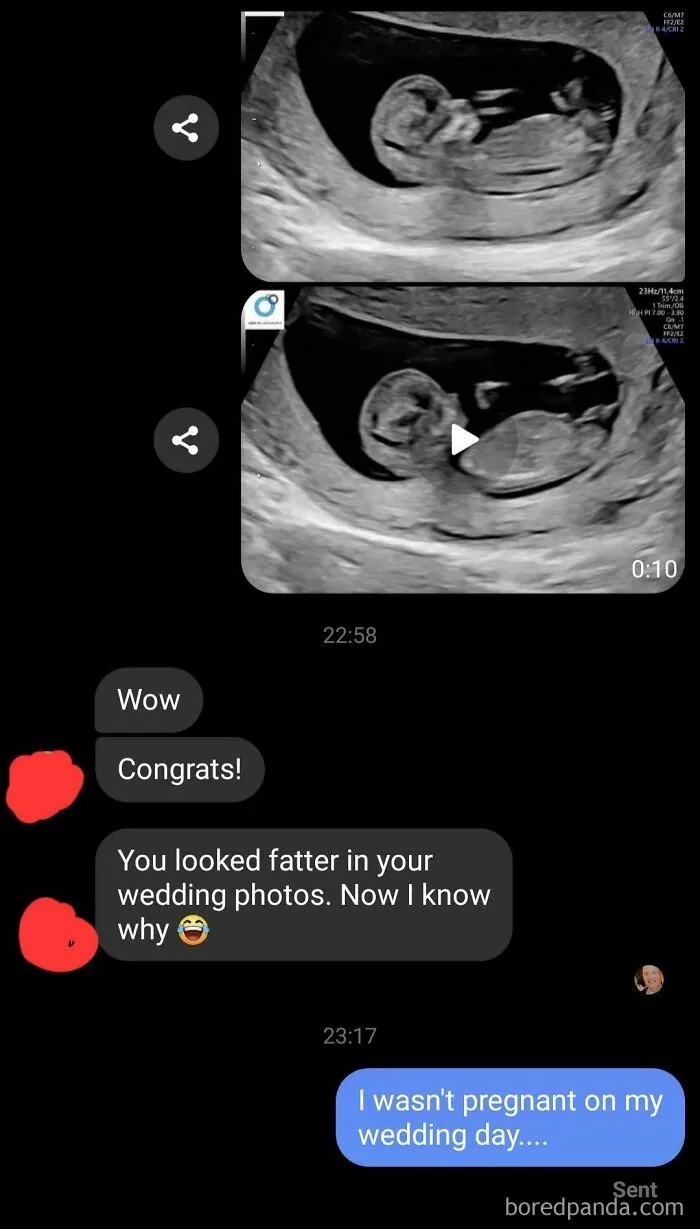 Ultrasound images shared in text message with comment about wedding photos and pregnancy