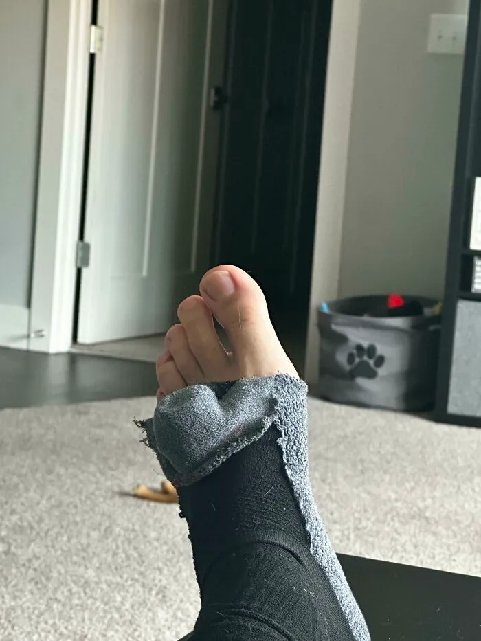 Bare foot wearing a severely torn gray sock, an example of things partners do that drive people insane.