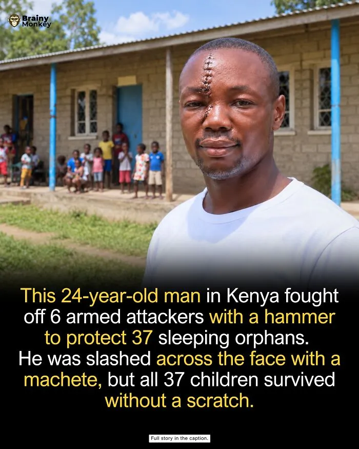 A young Kenyan man with a stitched face wound standing outside an orphanage, representing wholesome facts.