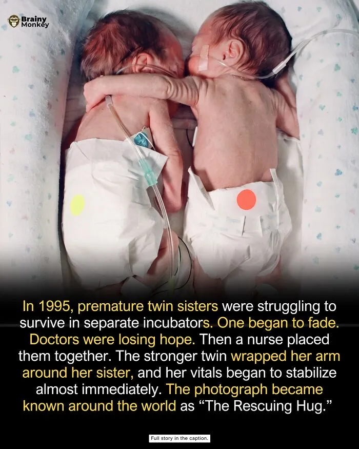 Premature twin infants hugging in an incubator as one of the wholesome facts