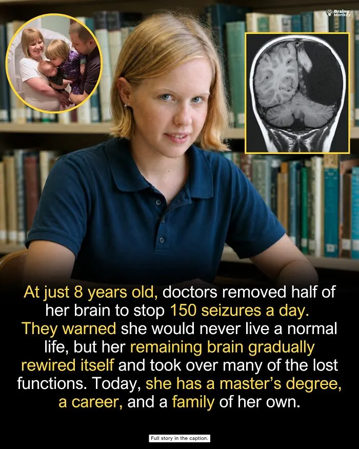 Young woman who recovered from brain surgery, highlighting wholesome facts