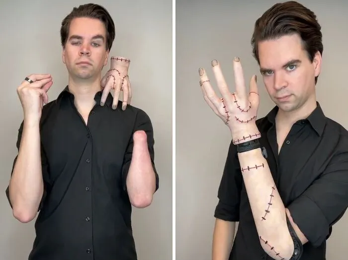 A man showing a custom hand prosthetic, representing creative people with disabilities winning Halloween.