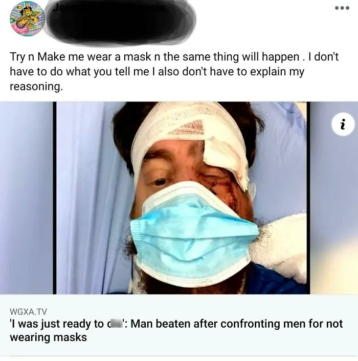 Man with serious facial injury wearing mask after confrontation over mask-wearing