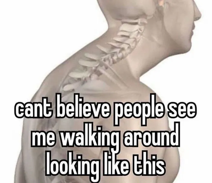 Absurd internet post depicting poor posture in a spinal diagram meme