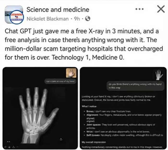 A post with a hand X-ray generated by ChatGPT, representing one of the absurd moments on social media.