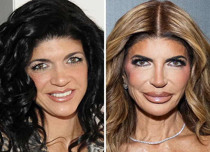 Before and after images highlighting extreme MAGA face changes of woman close to Trump