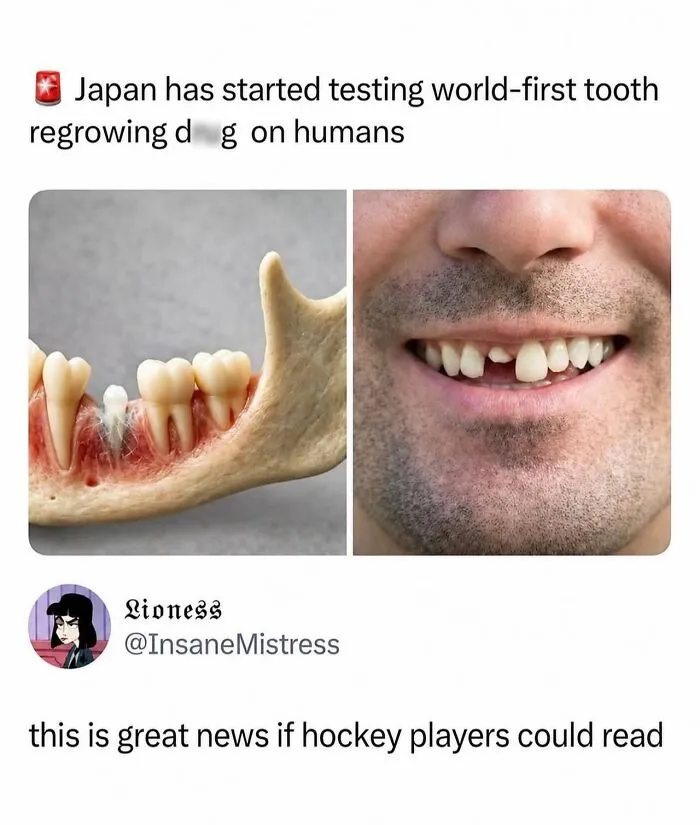 Funny memes about a new tooth regrowing technology and a joke about hockey players