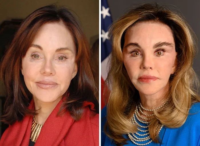 Comparison showing extreme MAGA face transformation of woman in Trump's circle
