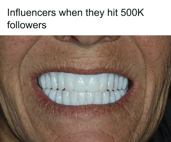 Meme featuring bright white veneers symbolizing influencers getting 500k followers.