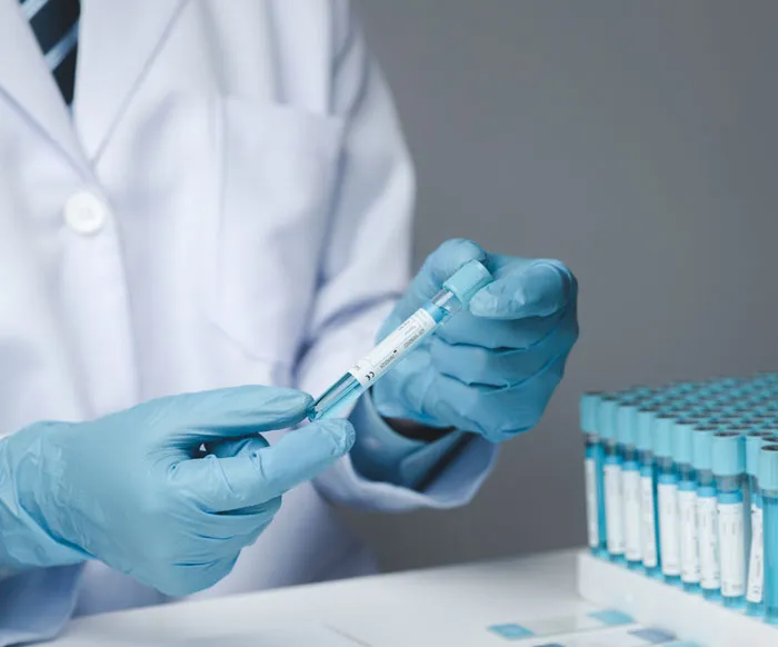 A scientist holding a blood sample tube relevant to paternity test divorce stories