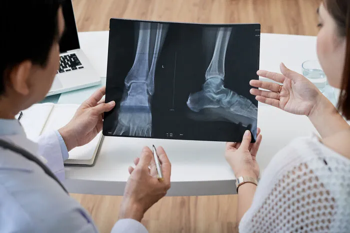 Healthcare workers reviewing a foot X-ray during a medical consultation with a patient.