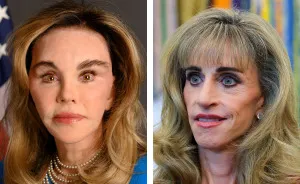 New Ambassador’s Portrait Draws Harsh Comparisons To Susan Dell As People Spot Troubling Pattern: "MAGA Face"