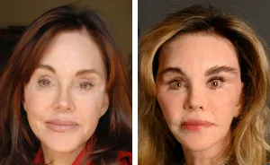 “The Aliens Are Already Here”: 10 Women In Trump’s Circle Whose Before-And-After Photos Sparked “MAGA Face” Debate