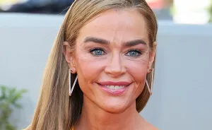 Denise Richards’ $200K Facelift Fuels ‘The Substance’ Comparisons As Before-And-After Photos Go Viral