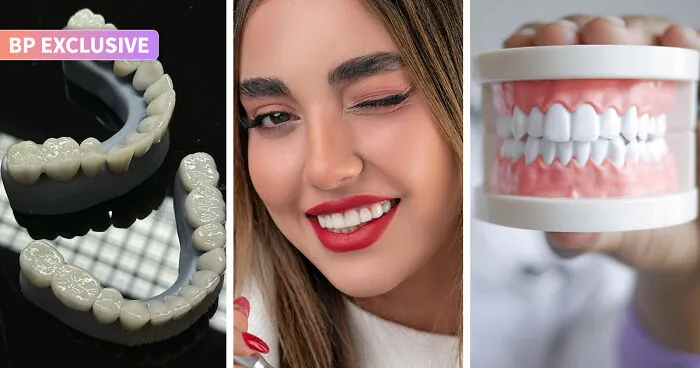The Truth Behind Turkey Teeth: Why So Many People Book Them And What Can Go Wrong