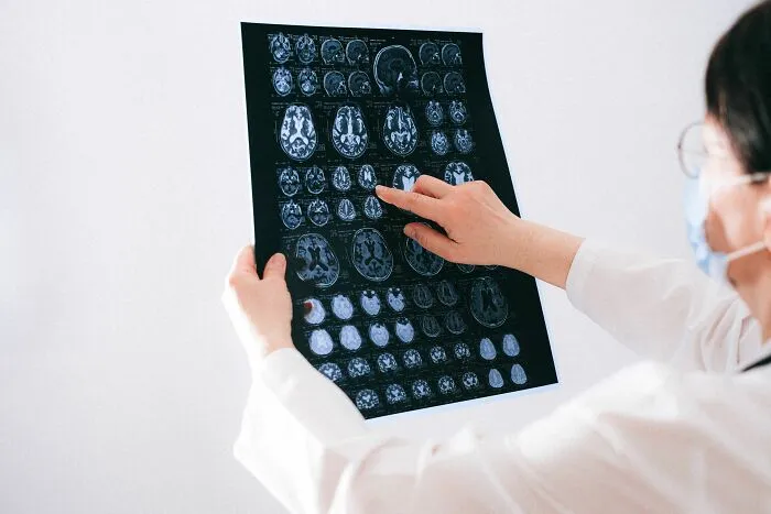 Doctor looking at brain scans, highlighting human body facts about the nervous system.