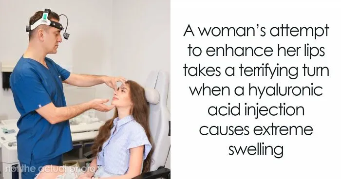 Woman Shares Shocking Lip Filler Results After A Cosmetic Injection Leaves Her In Tears