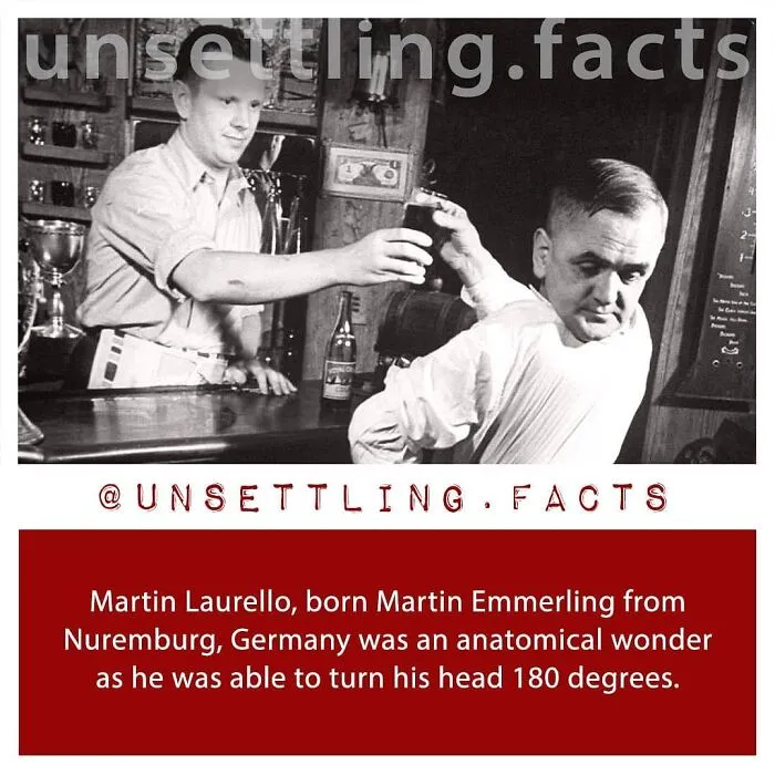 Unsettling facts: Man Martin Laurello who can turn his head 180 degrees