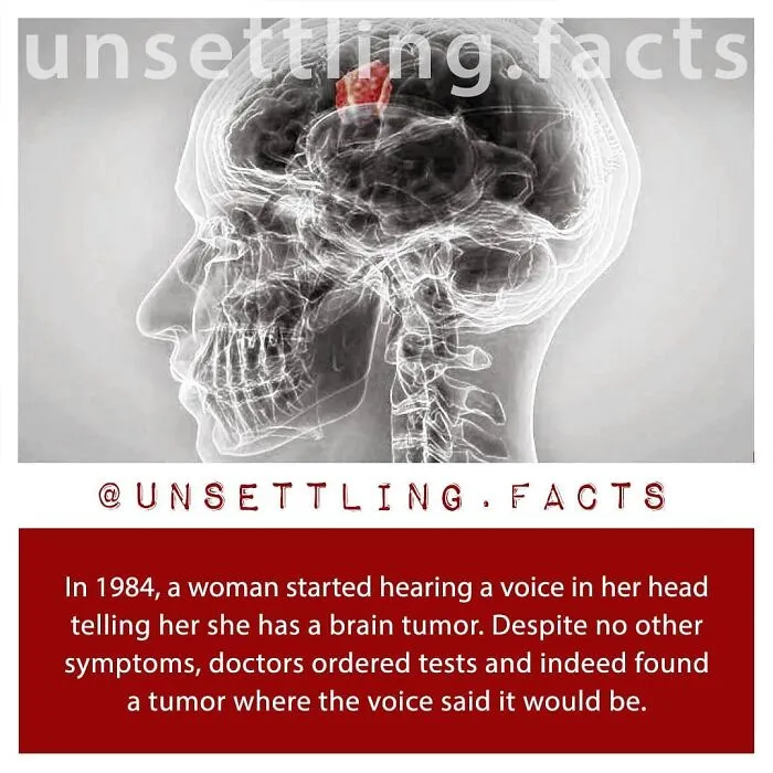 An X-ray of a human skull showing a highlighted brain tumor, related to creepy and unsettling facts