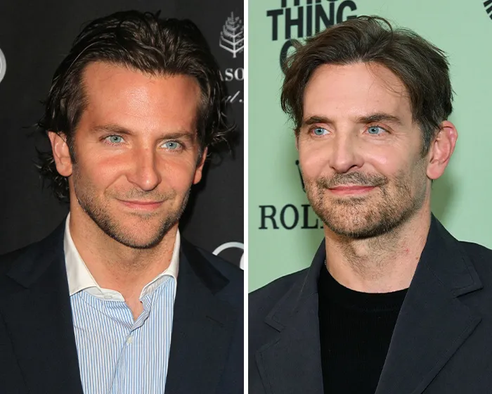 Before and after comparison of Bradley Cooper showing possible blepharoplasty plastic surgery.