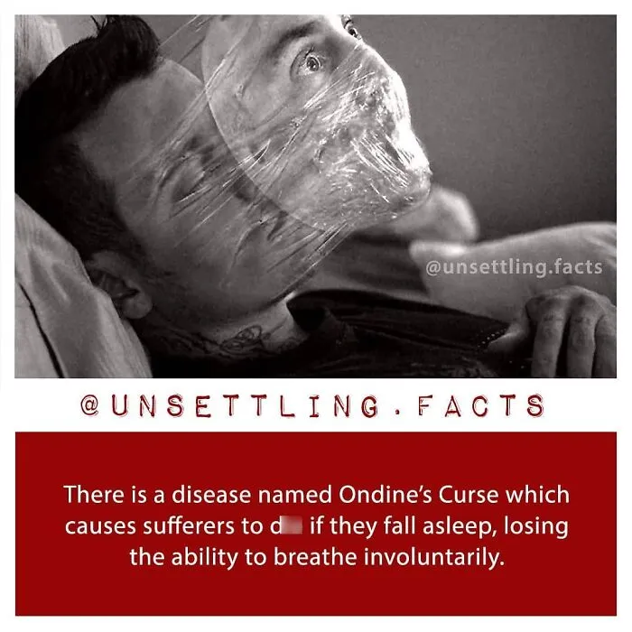 Creepy and unsettling facts text below a man with plastic wrap over his face, illustrating Ondine’s Curse.