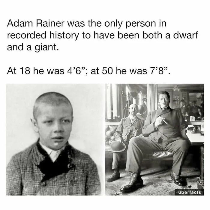 An unsettling fact about Adam Rainer featuring black and white historical photos of him as a youth and as a giant