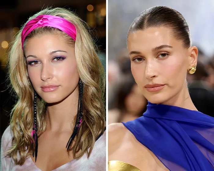 Side by side photos showing Hailey Bieber before and after a possible blepharoplasty plastic surgery transformation.