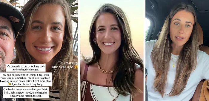 Woman shares gut health journey with photos showing skin and hair improvements