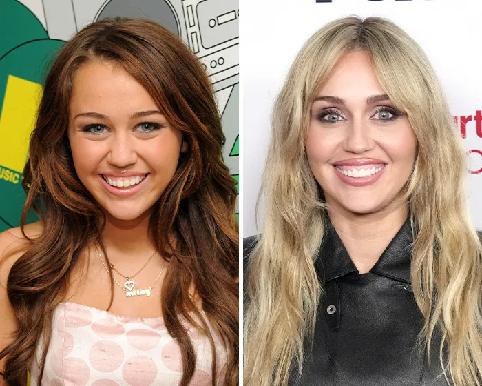 Side by side before and after images of Miley Cyrus discussing celebrity blepharoplasty plastic surgery rumors.