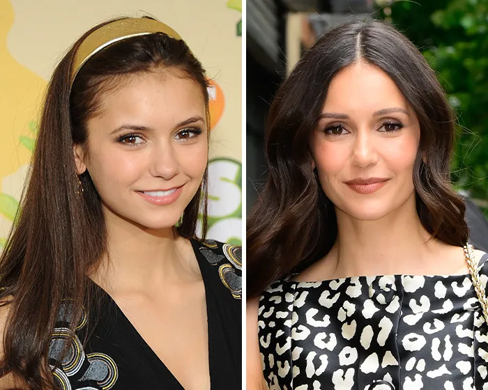 Side-by-side comparison of Nina Dobrev showing potential blepharoplasty plastic surgery results.