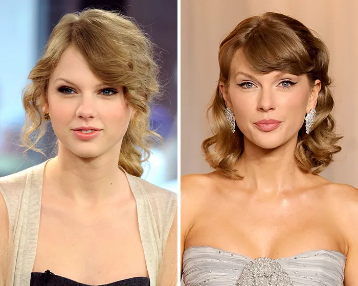 Comparison photos of Taylor Swift illustrating rumored blepharoplasty plastic surgery changes.