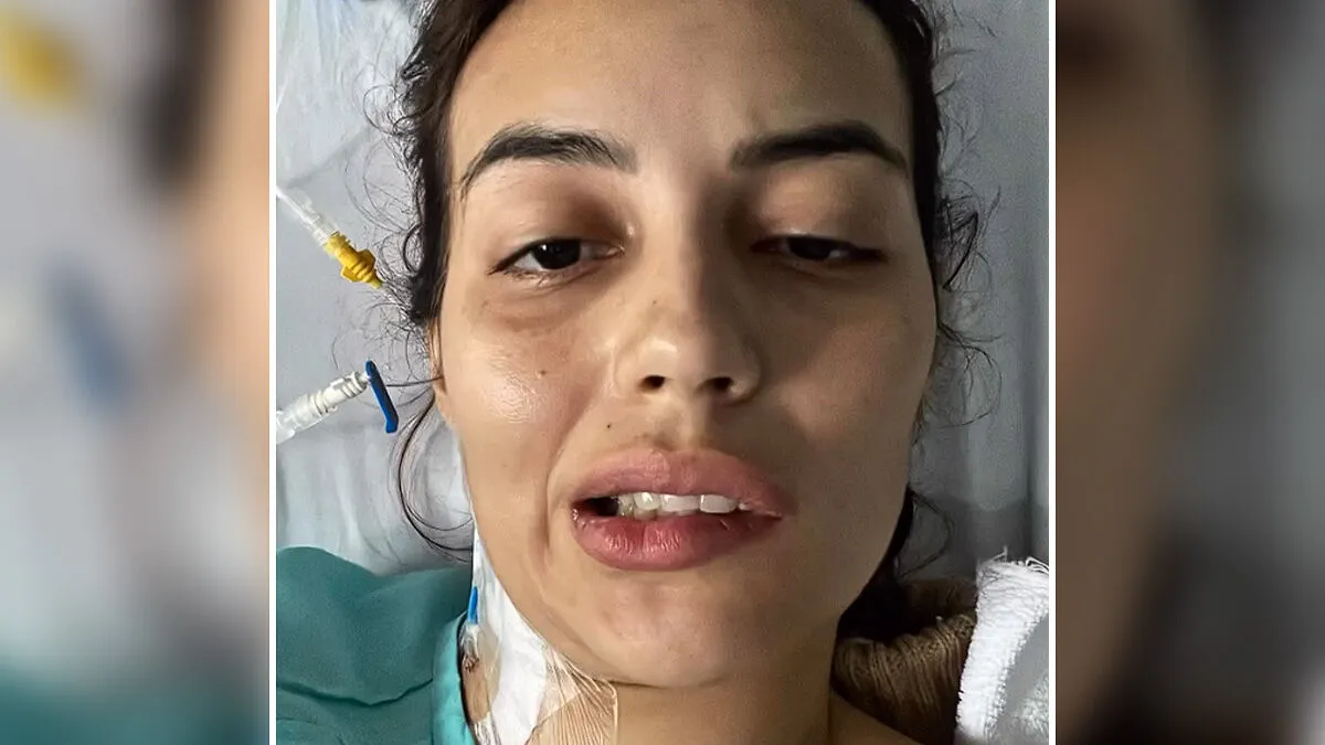 Young Influencer Left With Facial Paralysis After 23-Day Period In ICU Over Eating Sushi, Doctors Explain The Risks