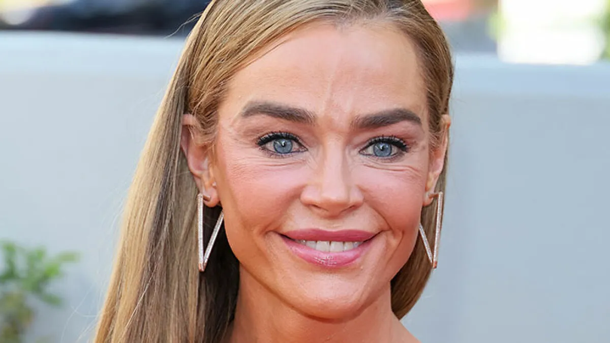 Denise Richards’ $200K Facelift Fuels ‘The Substance’ Comparisons As Before-And-After Photos Go Viral