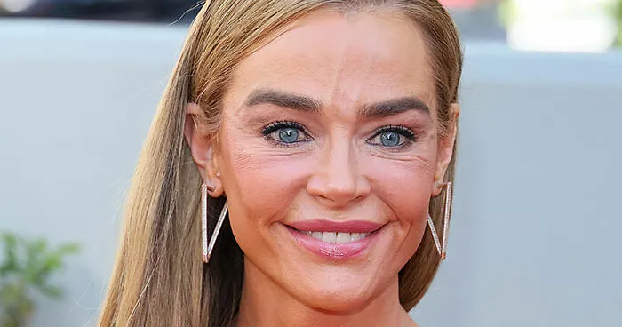 Denise Richards’ $200K Facelift Fuels ‘The Substance’ Comparisons As Before-And-After Photos Go Viral