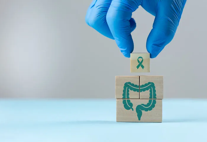 Hand in blue glove placing a colon cancer awareness ribbon block on wooden cubes representing colon health in Gen Z.