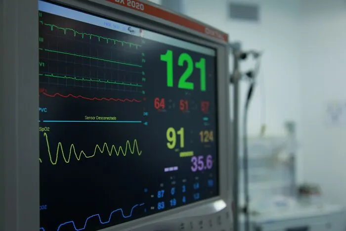 Medical monitor showing patient vitals in hospital room