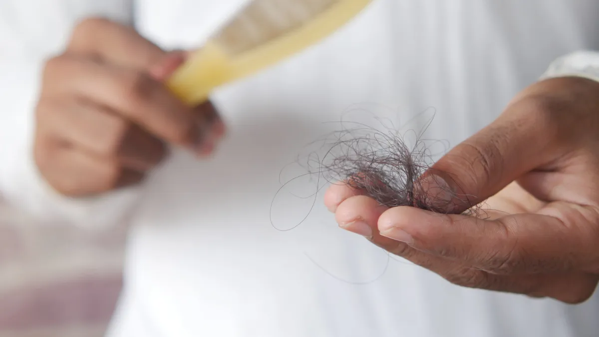 GLP-1 Users Intended To Lose Weight, But Many Of Them Say They’re Losing Hair Too