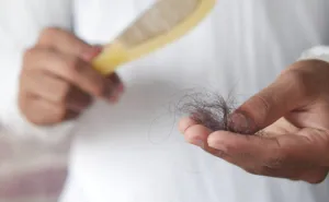 15% Of Americans Have Taken A GLP-1, And Dermatologists Now Have A Timeline For When The Hair Goes