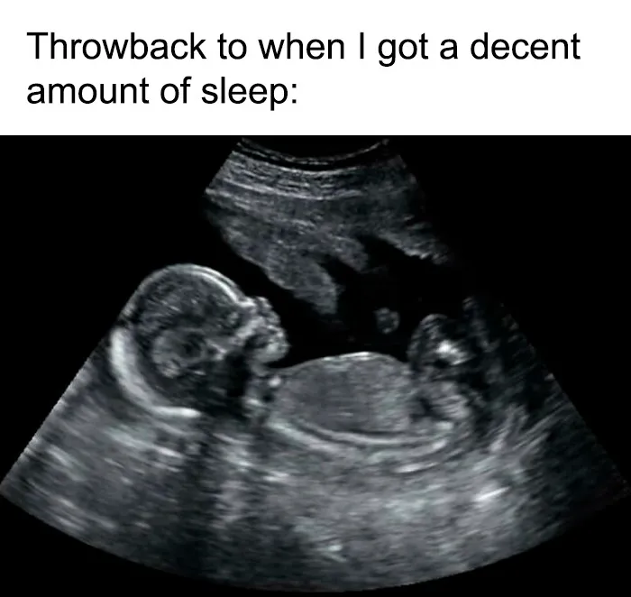 Ultrasound image representing a throwback to a decent amount of sleep meme