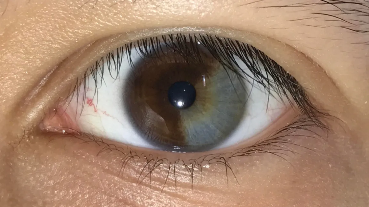 66 Cool Pics Of Unusual Body Traits And Conditions People Have