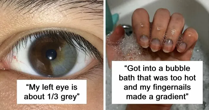 66 Stupefying Photos Of The Human Body That You May Not Have Seen Before