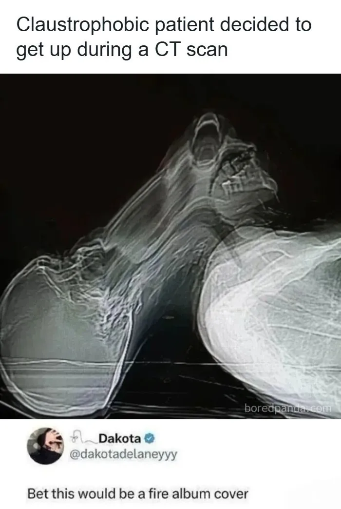 A blurry distorted CT scan image with text above and below, an example of wholesome memes.