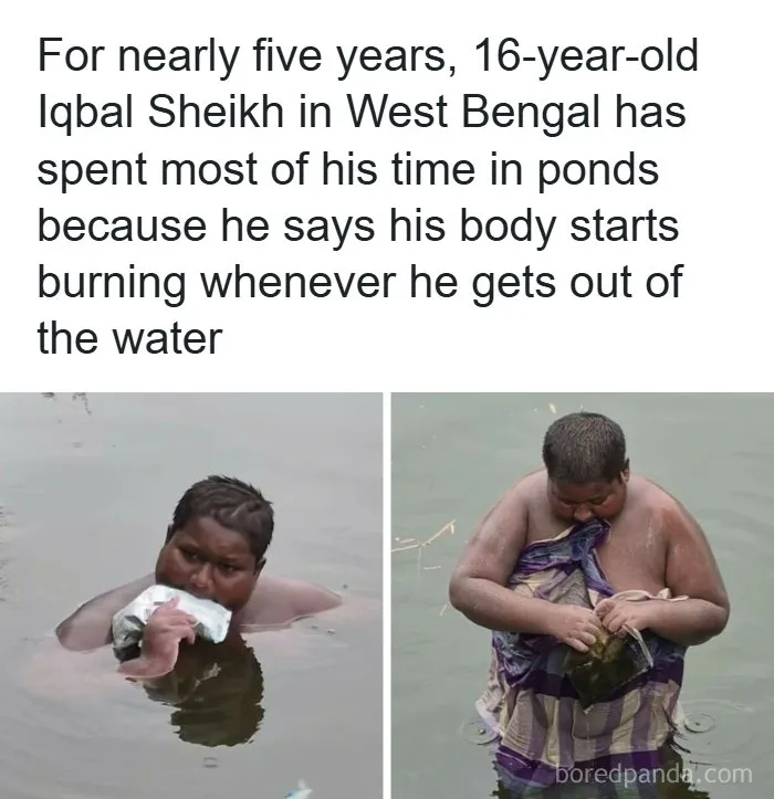 A teenage boy standing in water because his body burns when he gets out