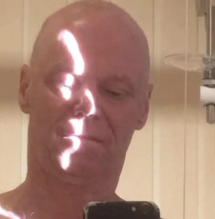 Light reflection on a man face creating confusing visual effects.