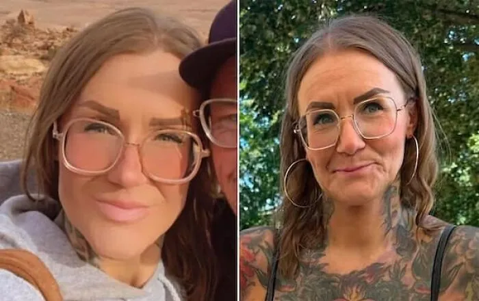 Before and after edited photos of woman with distorted facial appearance