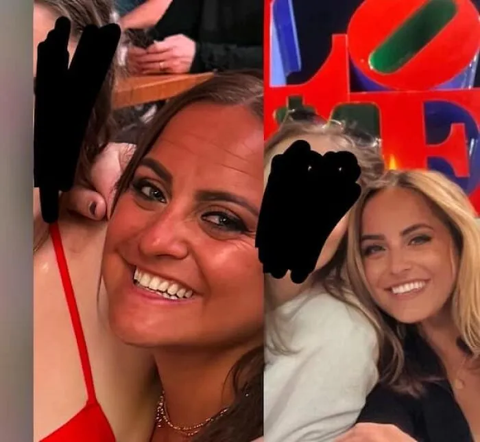 Ridiculously edited side-by-side photos of women with unnaturally enhanced smiles