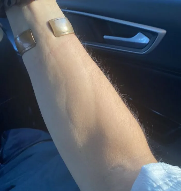 Close-up of a forearm with fine hairs caught in lighting for weird and slightly creepy photos