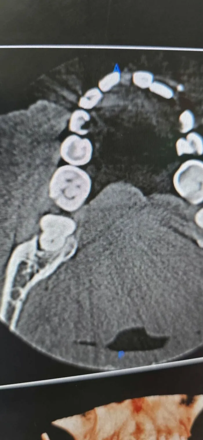 A dental CT scan showing tooth roots and jaw structure, an example from disturbing medical photos.
