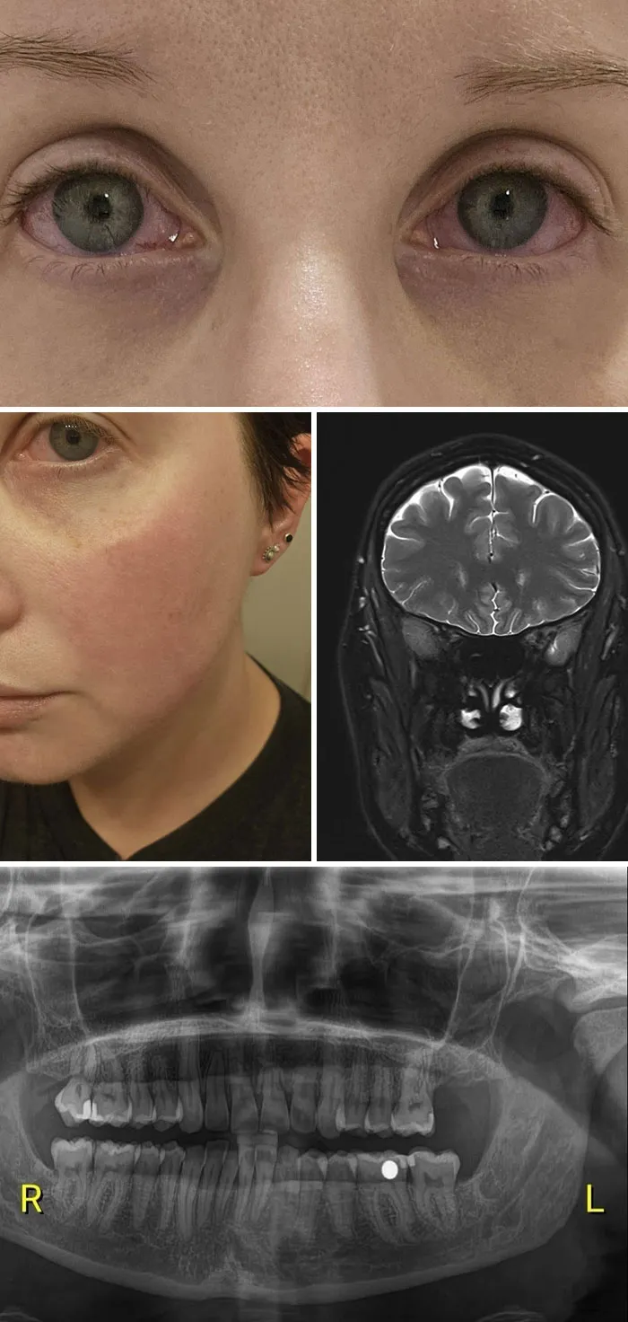 Collage of facial rash, brain MRI, and dental X-ray depicting disturbing medical photos.